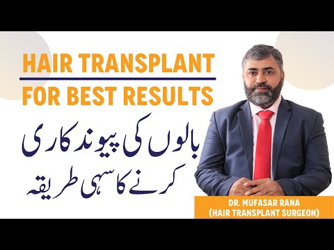 Hair Transplant Surgery Kaise Hoti Hai - Baalon Ki Pewand Kari - Hair Transplant For Best Results