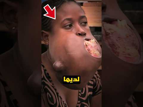 هذه المرأة تحدت المستحيل وحققت حلمها 🥹❤️🩹