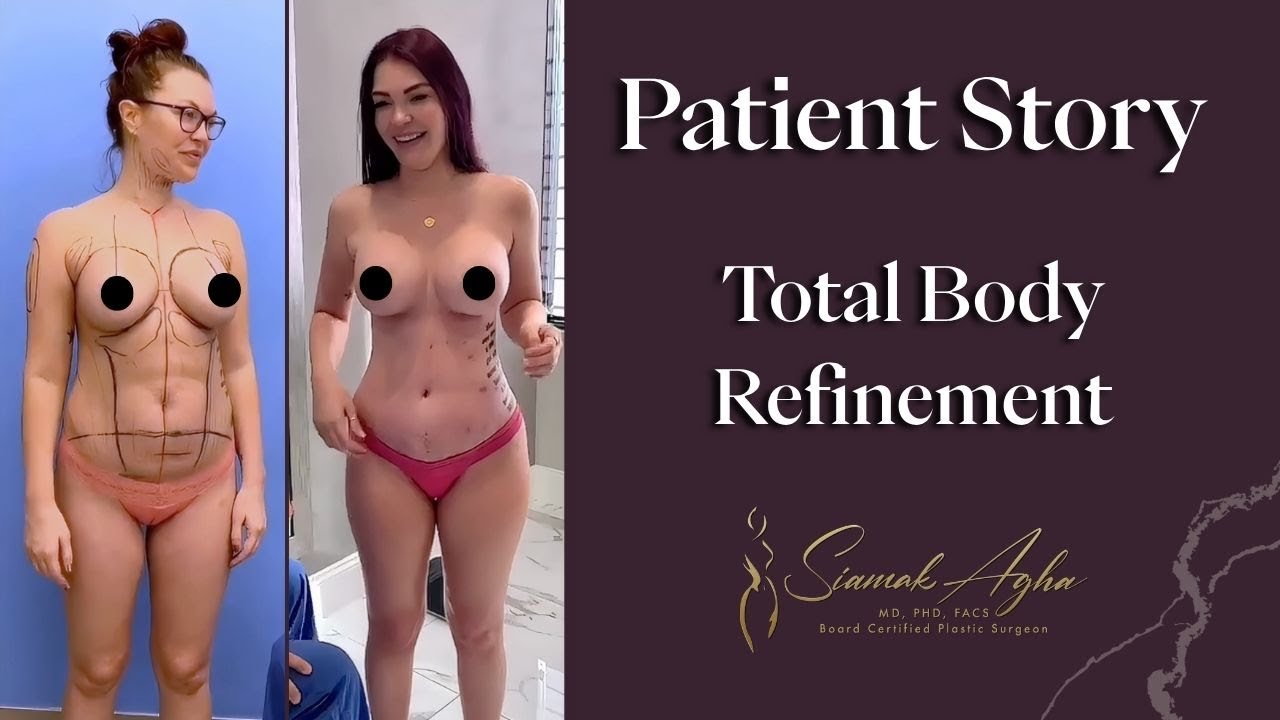 Before and after total body refinement journey.