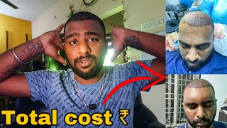 Full Details About My Hair Transplant | Cherry Vlogs