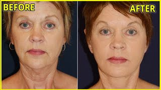 Anti aging magic cream 🌷stimulates collagen and fills in deep wrinkles and fine lines