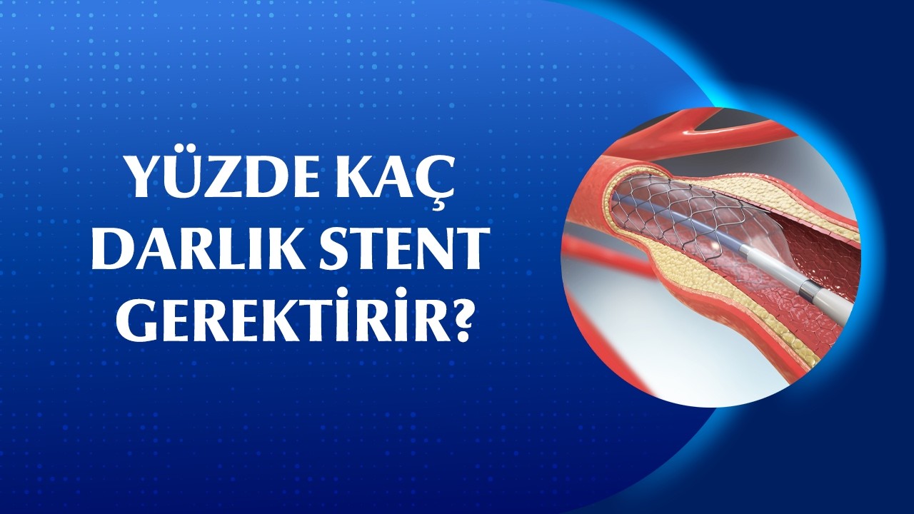 Yüzde Kaç Damar Darlığında Stent Takılır?