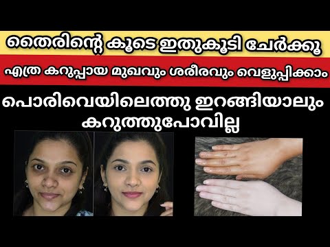 വെറും തൈര് മതി കറുത്തിരുണ്ട മുഖവും പാല്പോലെ വെളുത്ത കണ്ണാടിപോലെ തിളങ്ങും/curd facepack at home