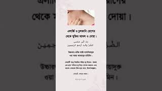 এনার্জি ও চুলকানি থেকে মুক্তির দোয়া ও আমল।                         #islamicvideo #cure #amal #video
