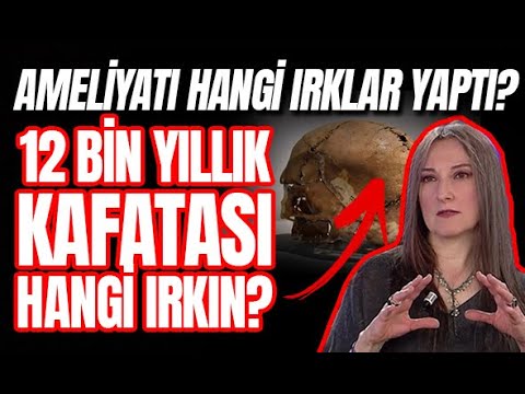 BU KAFATASI KİMİN? 12BİN YILLIK BEYİN AMELİYATINI HANGİ IRKLAR YAPTI? - FARAH YURDÖZÜ