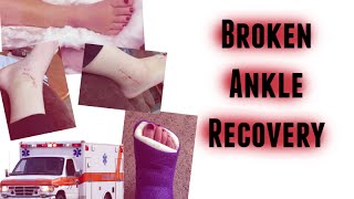 Broken Ankle Recovery: From Surgery to Today (w/ Pictures)