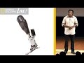Understanding Prosthetic Socket Discomfort and Solutions