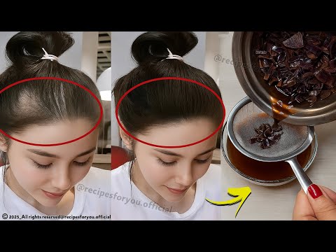 Spray it on your hair for 2 days,🌾Hair grows like crazy and doesn't fall out,🧅grandmother recipe!