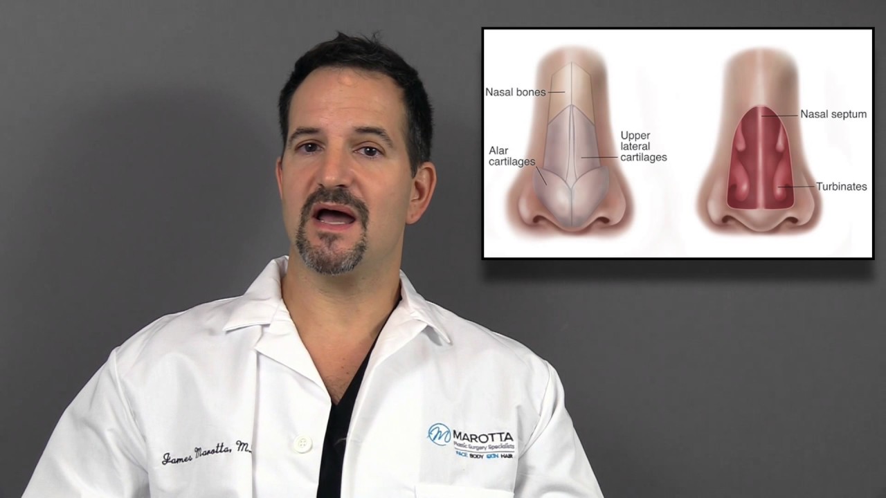 Doctor explaining nasal anatomy with diagrams.