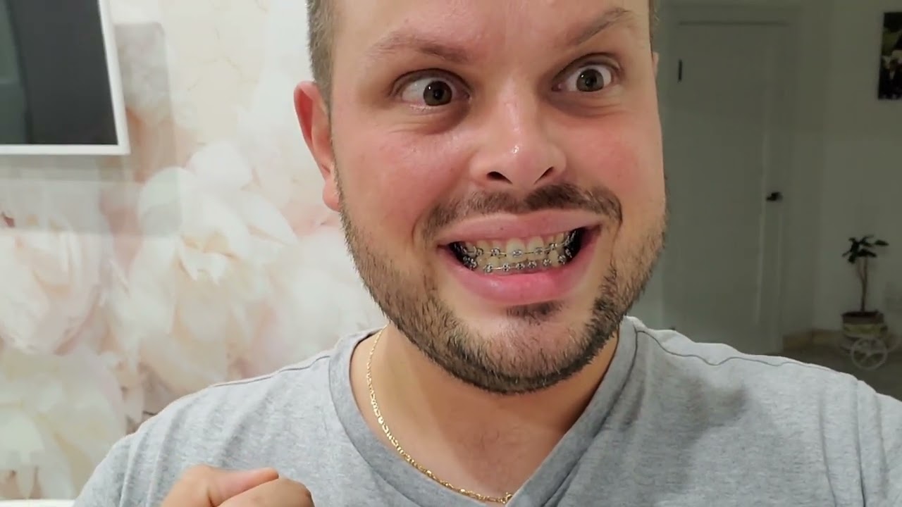 Приехал к маме! Опухла нога! Вкусная жарена картошка