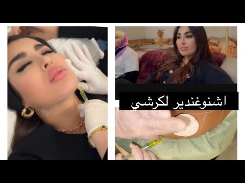 من بعد الخدمة مشيت نحيد الكرش و الدقن المزدوج😱صاحبتي جات تريشني في محالي😁