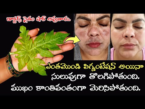 కేవలం 7 రోజులు చాలు 🌟పక్కా రిజల్ట్ 👍మొండి పెగ్మెంటేషన్ పోవడం సాధ్యమే! 🤯డాక్టర్లకే షాక్ ఇచ్చిన చిట్కా