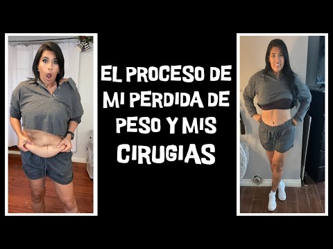 EL PROCESO DE MI PERDIDA DE PESO Y MIS CIRUGIAS | TRANSFORMACION KETO | dieta keto