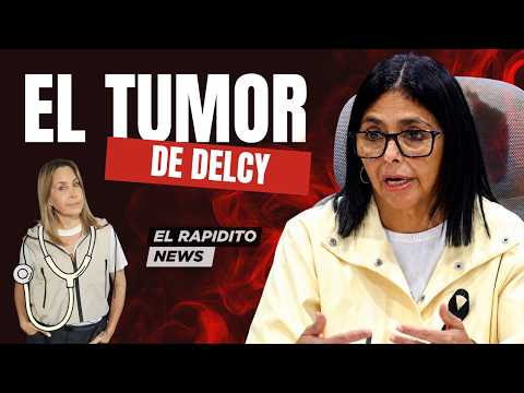 EL TUMOR DE DELCY: La metáfora que explica TODO lo que pasa en Venezuela