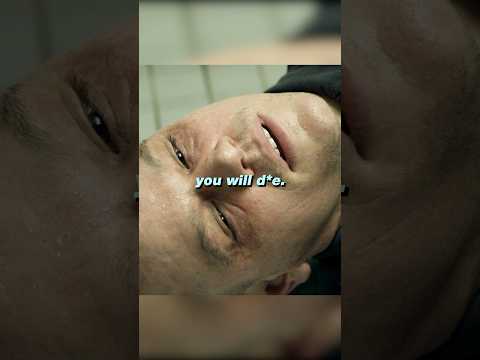 Received a lethal dose of radiation because of his superiors😱😔