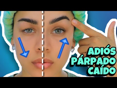 ADIÓS PÁRPADO CAÍDO!!! MASAJES PARA LEVANTAR PÁRPADO.