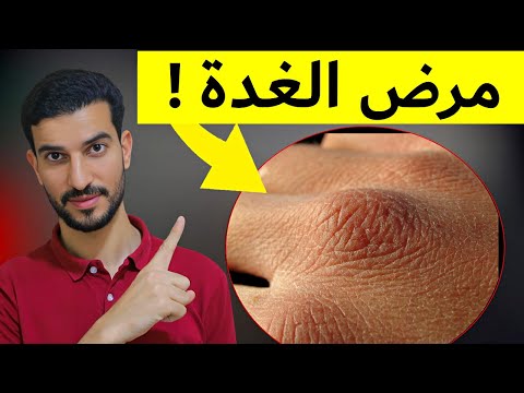 10 علامات لخمول الغدة يمكنك رؤيتها!