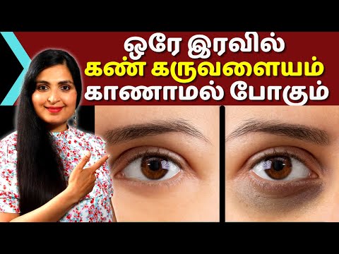 OVERNIGHT Dark Circles Remedy/ ஒரே இரவில் கருவளையங்களைப் போக்க|/ Undereye Cream  #Darkcircle
