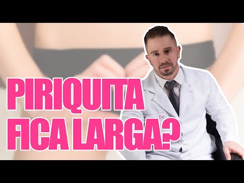 PIRIQUIT@ MUITO USADA FICA LARGA?? - DR BRUNO JACOB
