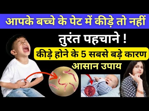 बच्चे के पेट में कीड़े हों तो कैसे पहचाने? 5 कारण और उपाय | Stomach Worms in babies In Hindi