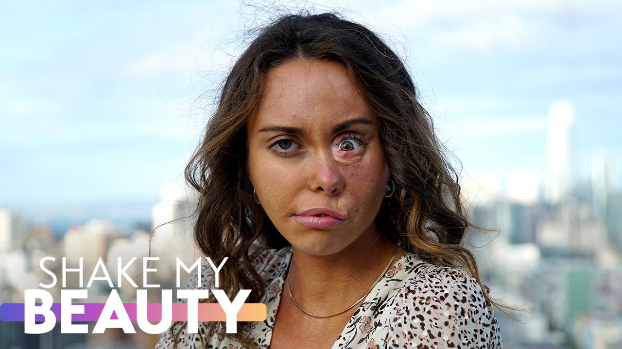 My cleft scars are my favourite feature - shake my beauty