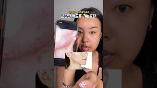 턱드름? 여드름 커버 꿀팁