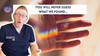 You will NEVER guess what we found in this patient's hand...