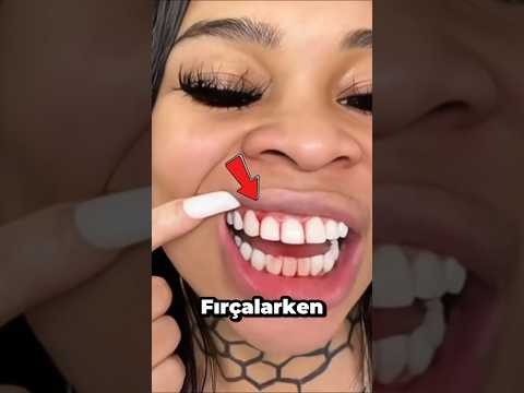 Diş Etleriniz Kanarsa HEMEN BUNU YAPIN 😱🦷