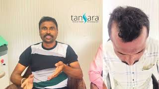 Advance FUE results Hair density & natural hair line