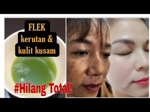 MODAL SERIBU‼️HEMPASKAN FLEK BANDEL &KERUTAN//WAJAH AUTO MULUS KEMBALI