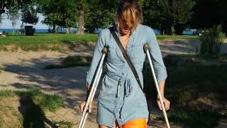 Long Leg Cast on Crutches on the beach!