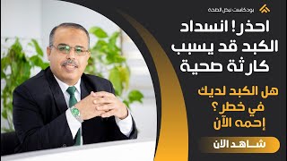 احذر! انسداد الكبد قد يسبب كارثة صحية خطوات لتنظيف الكبد كيف أخرج السموم من الكبد وتحرق دهون الكبد
