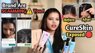 Baal Gir Rahe The… Tab Samajh Aaya Asli Problem 😳 | Honest Review #CureSkin #Cureskinapp