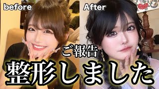 雨宮みるき整形しました！術後〜ダウンタイムも公開します