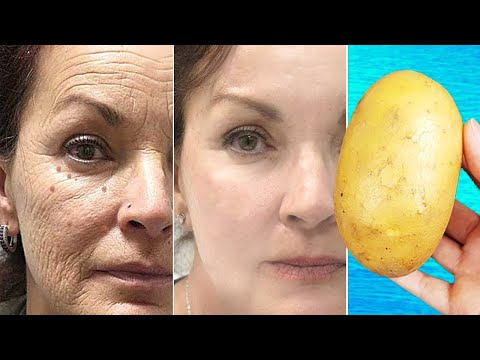 Wie man Kartoffeln verwendet, um Falten zu entfernen und dunkle Flecken im Gesicht zu verblassen