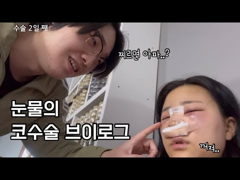 망한 줄 알았던 코수술