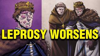Baldwin’s Struggle with Leprosy – The Story of the Leper King – Episode 6