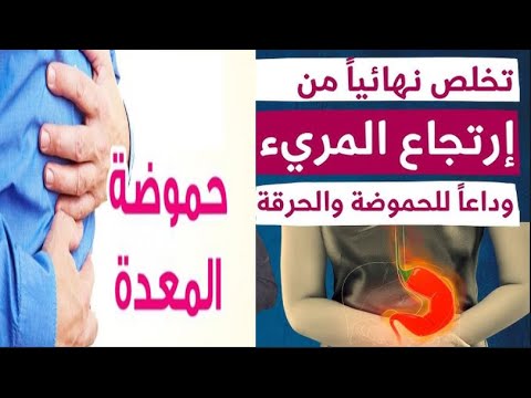 علاج حموضة المعده ارتجاع المريء / الحل السريع والنهائي لوقف الحموضه بدون ادوية