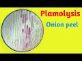 Plasmolysis in Onion Cells