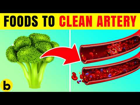 10 Vegetables To Clean Your Arteries And Prevent Heart Attack