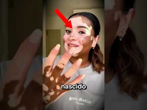 A modelo com duas cores de pele!