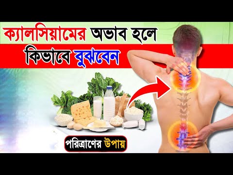 আপনার শরীরেও কি ক্যালসিয়ামের ঘাটতি আছে? দেরি না করে এখনি Step নিন নয়তো ডাক্তার আর কিছু করতে পারবেনা