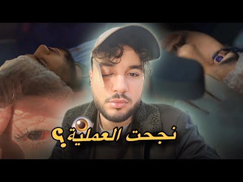 درت عملية على عيني 👁️نجحت العملية ؟ 😨