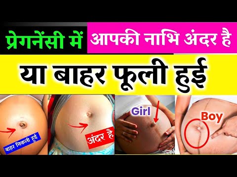 प्रेगनेंसी में नाभि का बाहर आना। pregnancy mein nabhi kab Bahar aati Hai | Navel botton in pregnancy