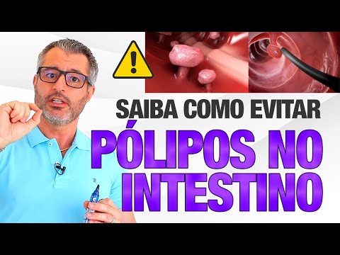 O que você precisa saber para evitar PÓLIPOS