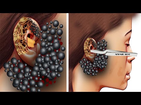 ASMR Animation Ear  Cleaning