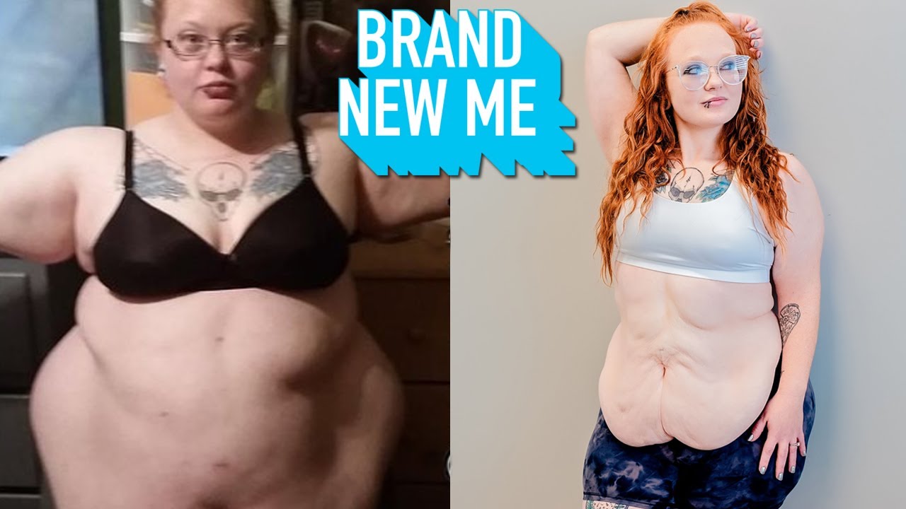 I lost 246lbs - today i reveal my excess skin - brand new me