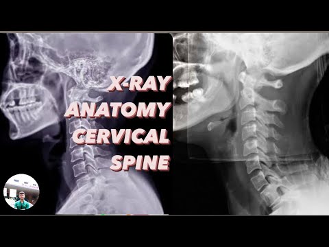 CERVICAL SPINE X-RAY