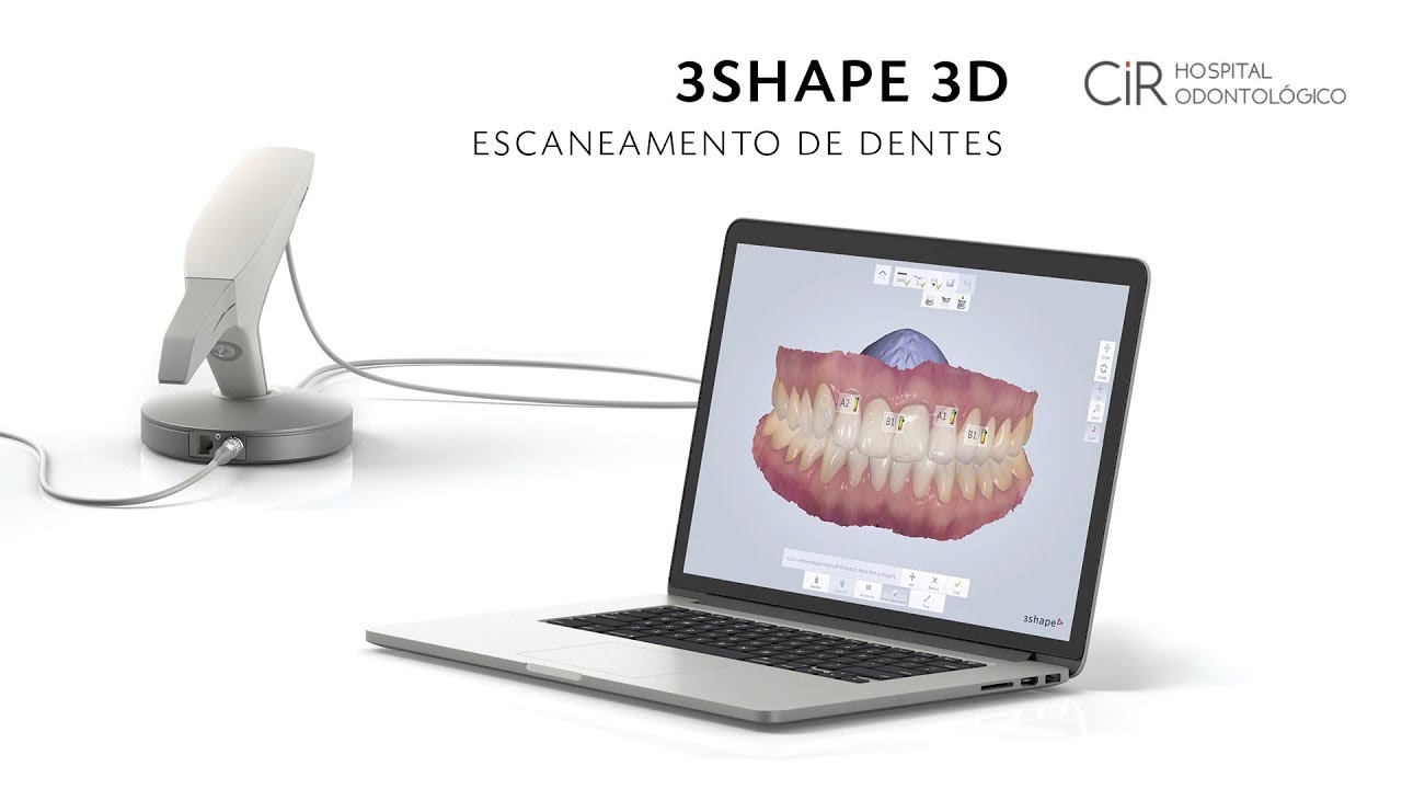 Escaneamento 3D