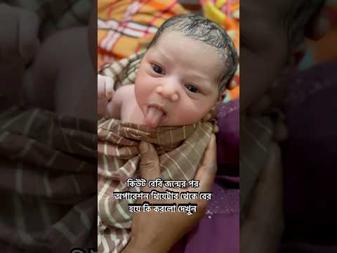 জন্মের পর বাবু টি সবাই কে অবাক করে দিলো #newbornbaby #baby #cute #newborn #infant
